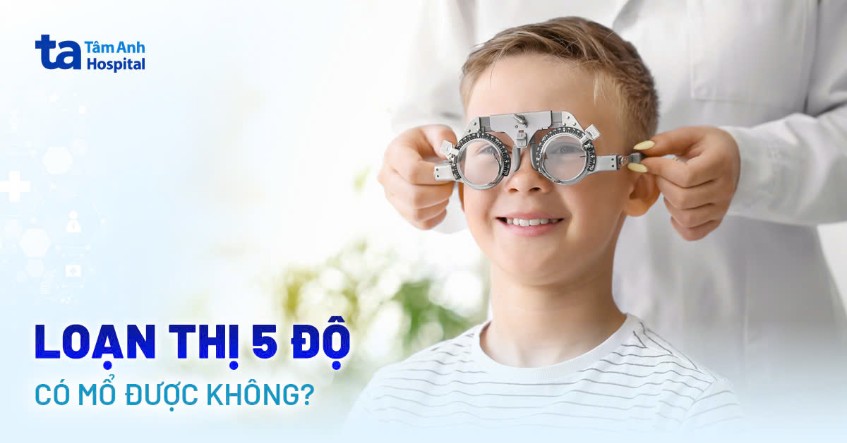 Loạn thị 5 độ có mổ được không? Chỉ định và điều trị ở đâu uy tín?