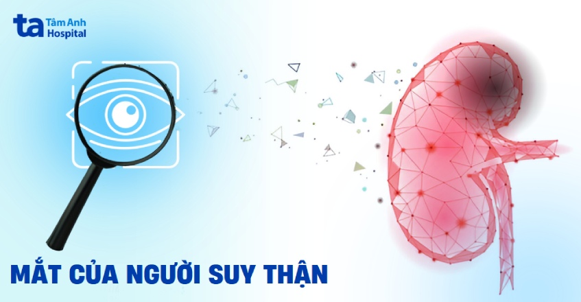 Mắt của người suy thận: Dấu hiệu, nguyên nhân và giải pháp bảo vệ