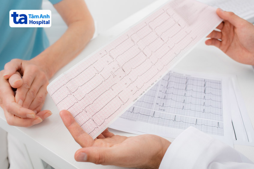 Minh họa điện tim block phân nhánh trái trước