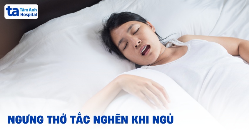 Ngưng thở tắc nghẽn khi ngủ: Nguyên nhân, triệu chứng, điều trị