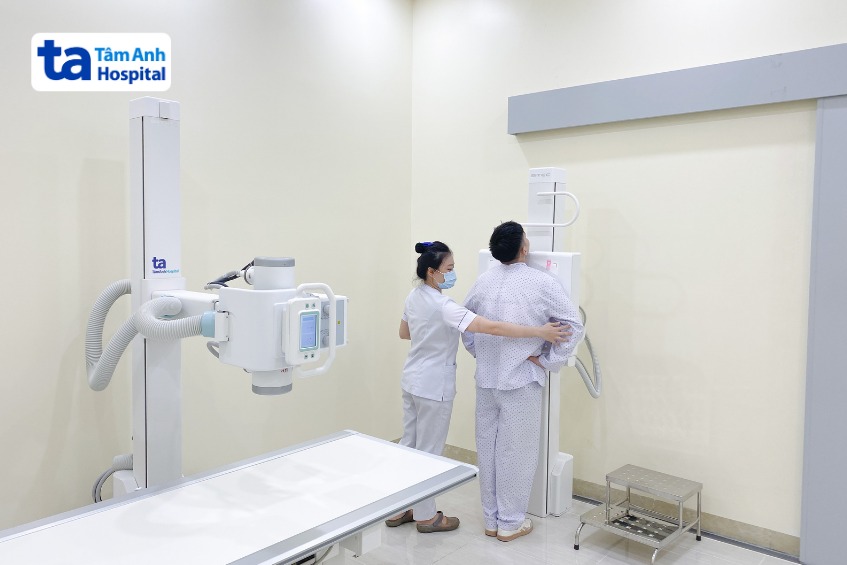 người bệnh có thể được chỉ định chụp x-quang phổi