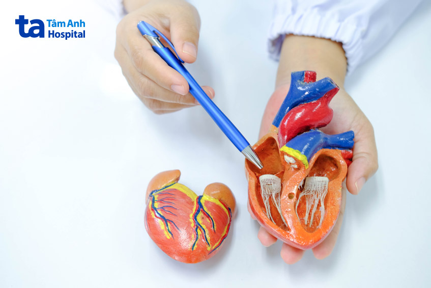 Người bệnh mạch vành cần lưu ý khi muốn vận động