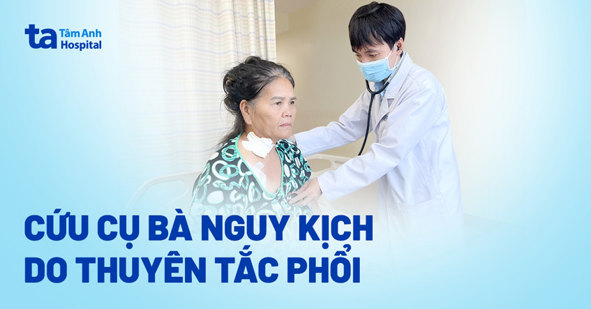 Người phụ nữ suy tim, suy hô hấp do thuyên tắc phổi