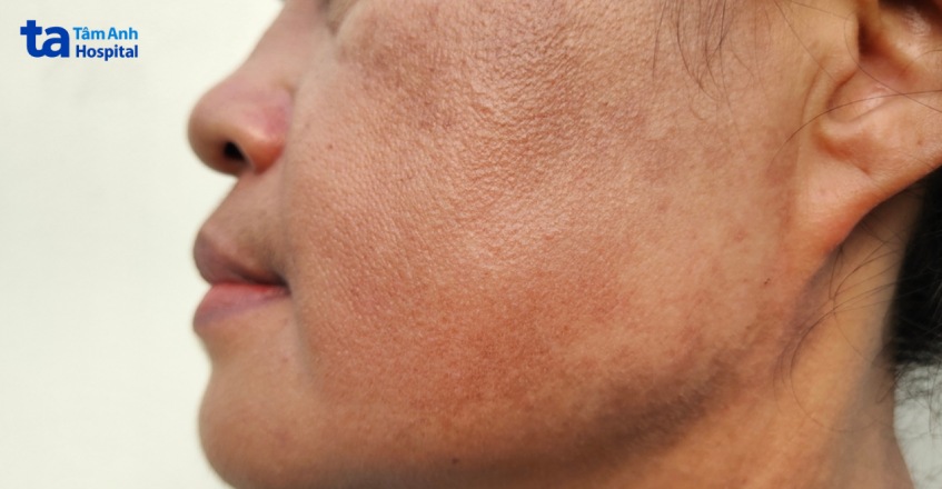 nguyên nhân da xỉn màu thiếu sức sống