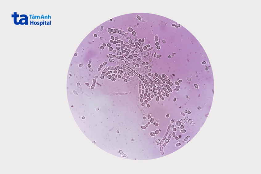 nguyên nhân gây nấm ở kẽ móng tay