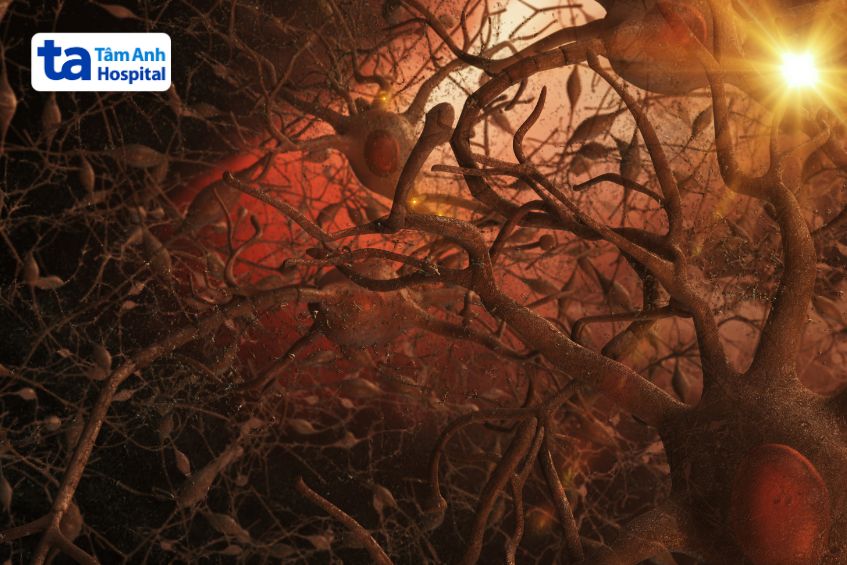 nhiều bệnh lý ảnh hưởng hệ thần kinh giao cảm