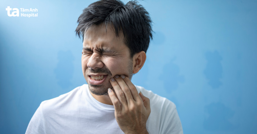 Thời gian sưng sau khi nhổ răng khôn