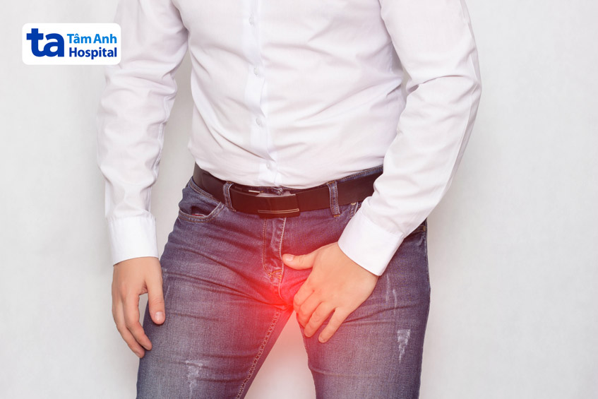 nóng rát sưng tấy vùng bìu