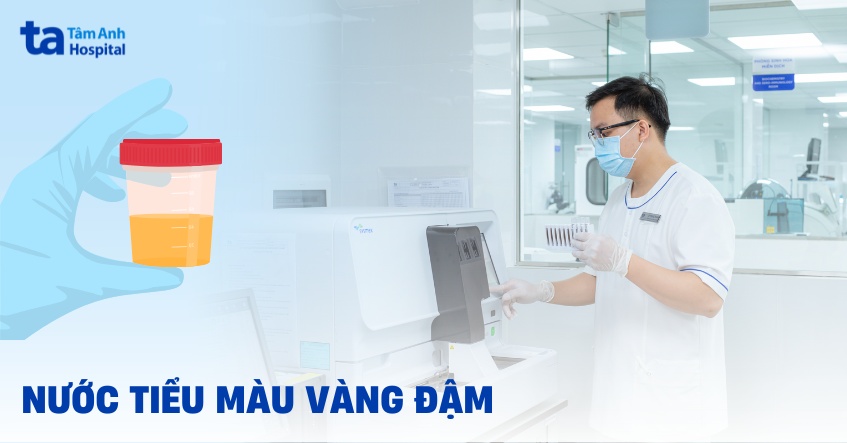 Nước tiểu màu vàng đậm có sao không? Nguyên nhân vì sao?