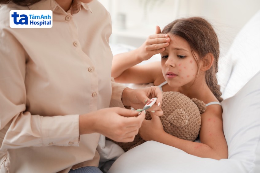 Tay chân miệng và thủy đậu có một số triệu chứng giống nhau