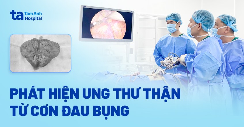 phát hiện ung thư thận từ cơn đau bụng