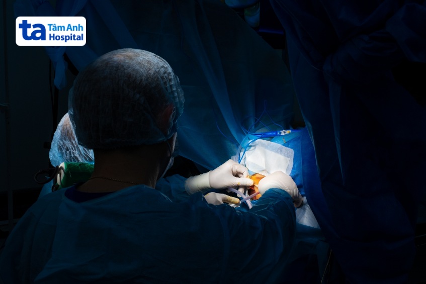 phẫu thuật chữa sa búi trĩ