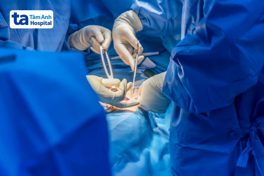 phẫu thuật điều trị nếu bệnh nghiêm trọng