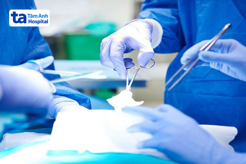 phẫu thuật loại bỏ khối u do hpv