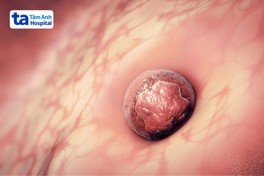 Phôi ngày 6 vẫn có tiềm năng làm tổ thành công