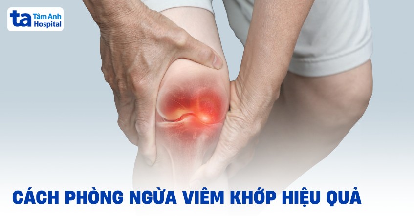 13 cách phòng ngừa viêm khớp hiệu quả người bệnh cần lưu ý