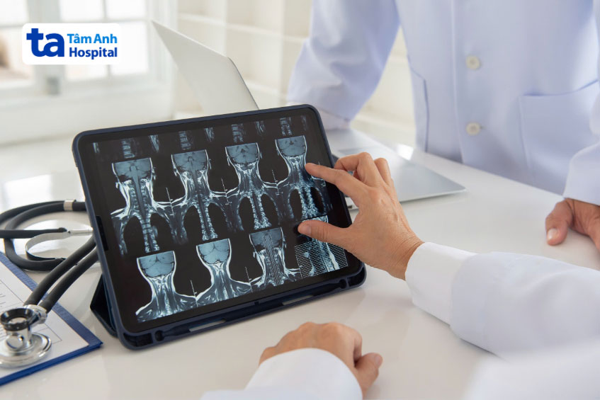 Phương pháp chẩn đoán đau cổ vai gáy bên phải
