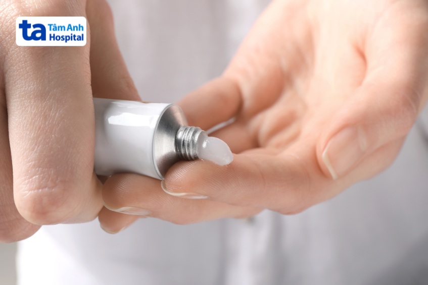 phương pháp điều trị bằng thuốc bôi, thuốc uống