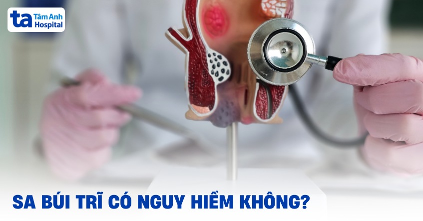 Sa búi trĩ có nguy hiểm không? Biến chứng có thể xảy ra