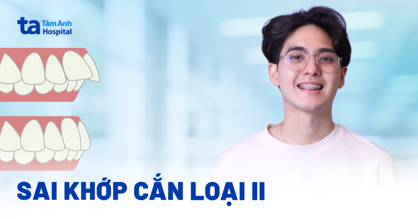 Sai khớp cắn loại 2 là gì? Nguyên nhân, tác hại và điều trị