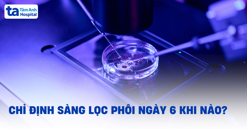 Sàng lọc phôi ngày 6 khi nào? Ưu điểm, quy trình và kết quả