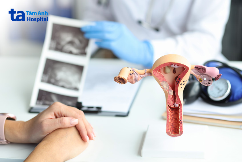 Siêu âm lạc nội mạc tử cung có thể gây khó chịu nhưng không đau