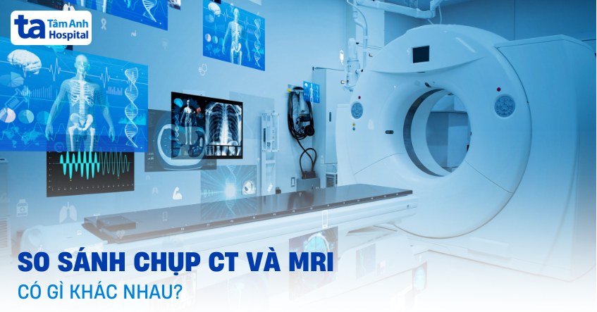 So sánh chụp CT và MRI có gì khác nhau? Phương pháp nào tốt hơn?
