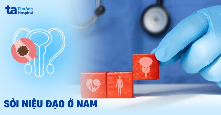 sỏi niệu đạo nam