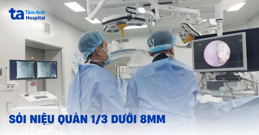 Sỏi niệu quản 1/3 dưới 8mm là gì? Điều trị như thế nào?