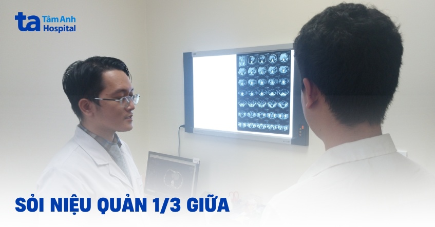 sỏi niệu quản 1 3 giữa