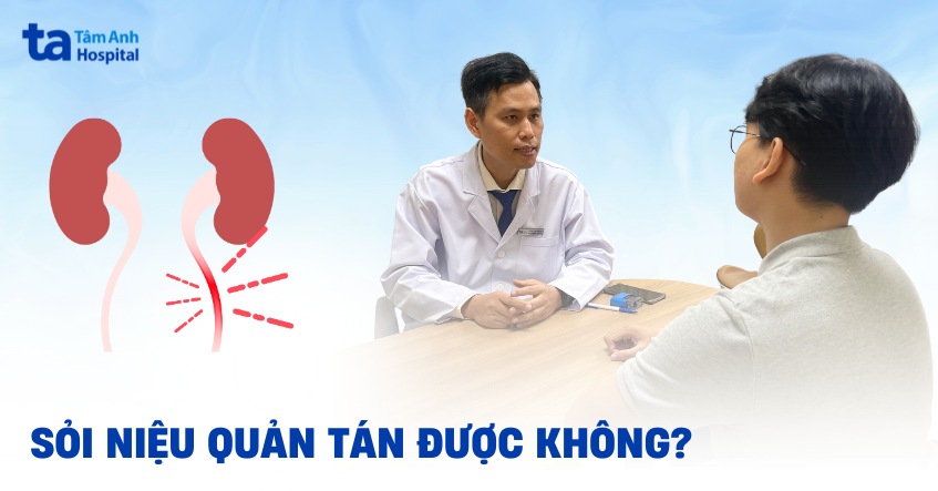 Sỏi niệu quản có tán được không? Có ảnh hưởng gì không?