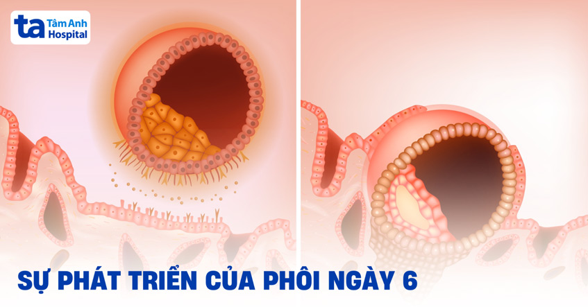 Phôi ngày 6: Đánh giá hình ảnh và sự phát triển chất lượng