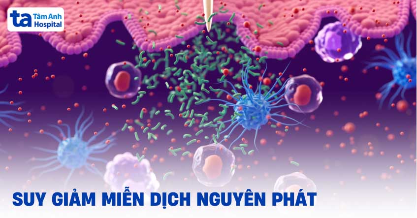 Suy giảm miễn dịch nguyên phát là gì? Nguyên nhân, triệu chứng