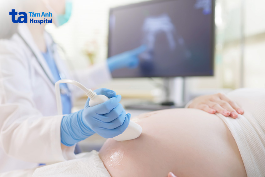 Suy tim thai có thể được chẩn đoán bằng nhiều phương pháp, trong đó có siêu âm