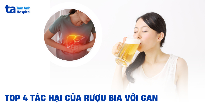 4 tác hại của rượu bia với gan, nguy hiểm không thể chủ quan
