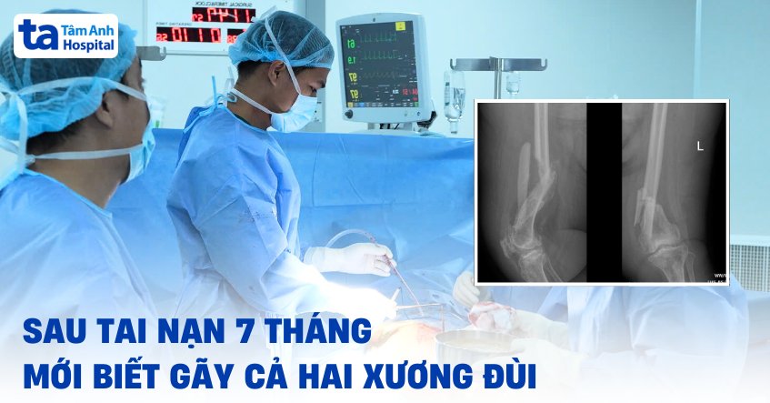tai nạn 7 tháng mới biết gãy hai xương đùi