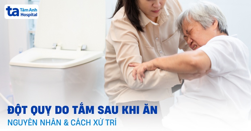 Tắm sau khi ăn đột quỵ nguyên nhân do đâu? Dấu hiệu và cách xử lý