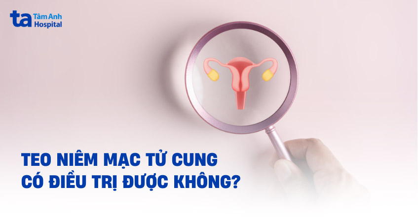 Teo niêm mạc tử cung: Nguyên nhân, dấu hiệu, điều trị được không?