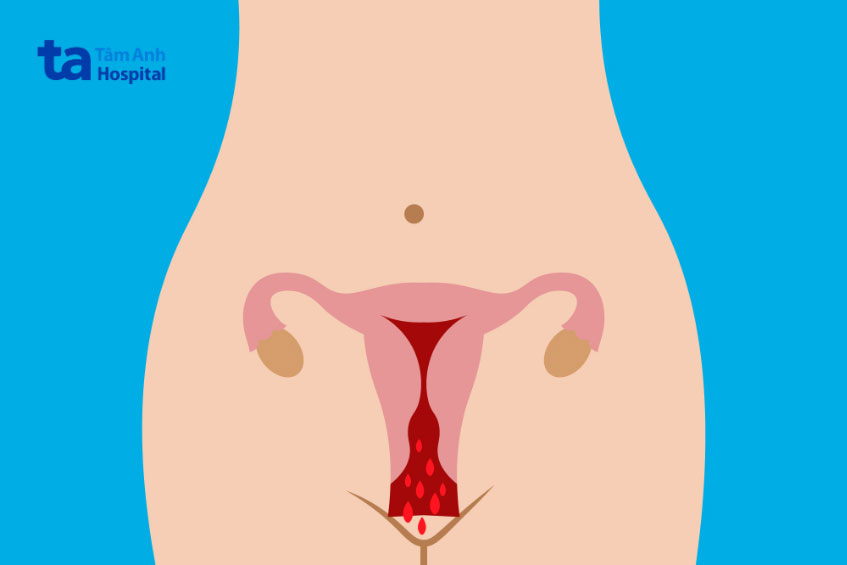 thăm khám ngay khi thấy dấu hiệu bất thường