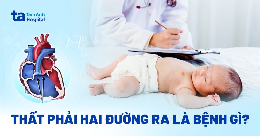 Bệnh thất phải hai đường ra là gì? Nguyên nhân, cách điều trị