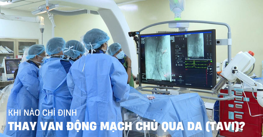 Thay van động mạch chủ qua da (TAVI): Quy trình, chỉ định khi nào?