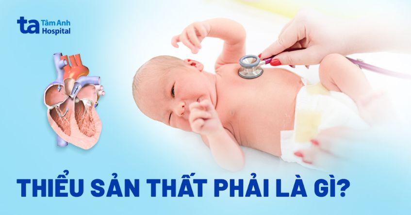 Hội chứng thiểu sản thất phải: Nguyên nhân, phân loại, điều trị