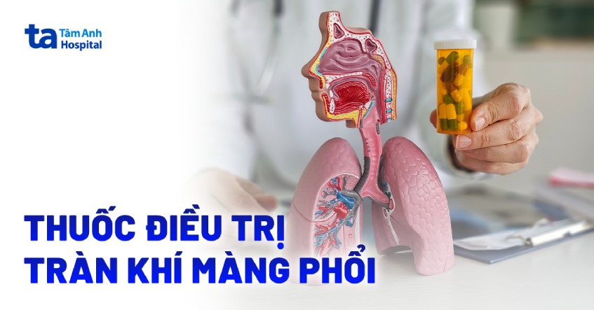 7 loại thuốc điều trị tràn khí màng phổi giúp cải thiện sức khỏe