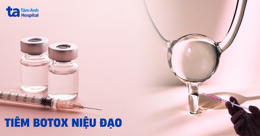 Tiêm botox niệu đạo khi nào nên lựa chọn? Ưu và nhược điểm