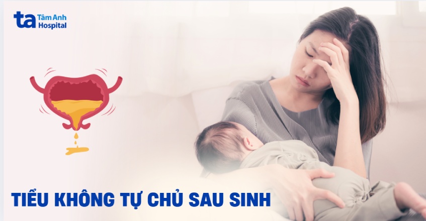 tiểu không tự chủ sau sinh