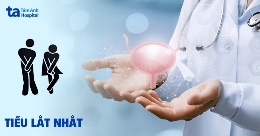 Tiểu lắt nhắt: Nguyên nhân, triệu chứng, chẩn đoán, điều trị