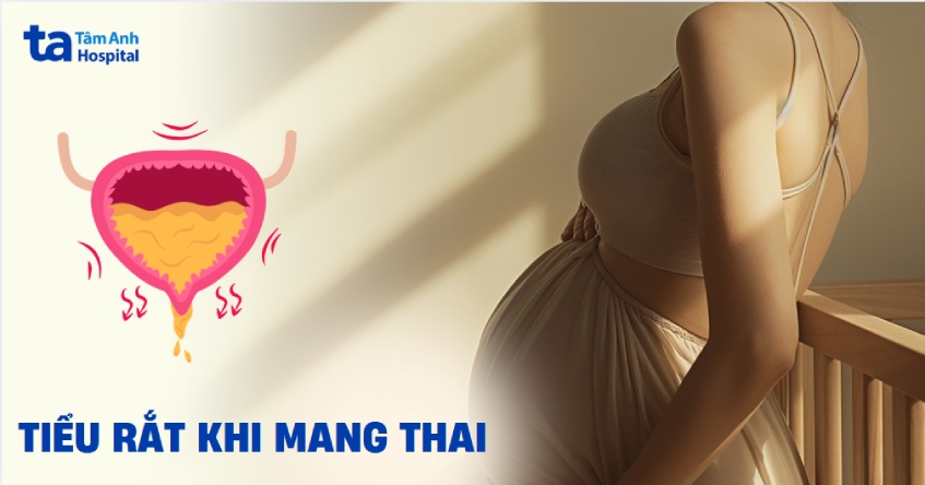 Tiểu rắt khi mang thai: Nguyên nhân, biểu hiện và cách điều trị