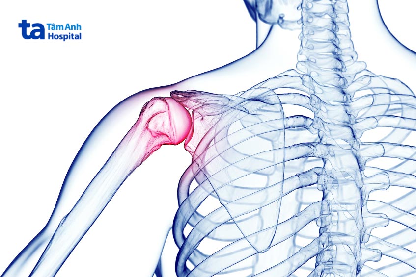 Tình trạng viêm khớp vai ảnh hưởng đến khả năng phục hổi