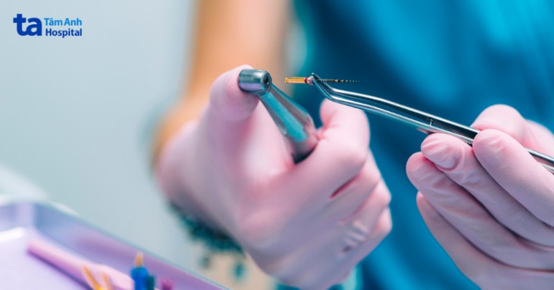 Trám răng lấy tủy có đau không?