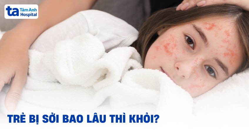 Trẻ bị sởi bao lâu thì khỏi? Yếu tố ảnh hưởng thời gian hết bệnh